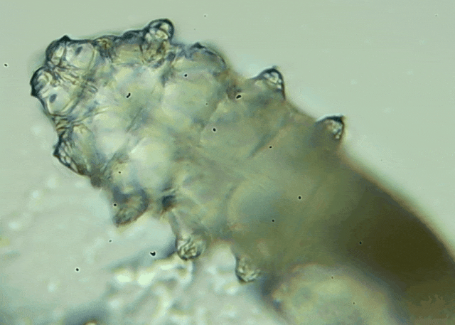 睫毛上驚現(xiàn)80只螨蟲！別揉了，快自查下你的眼睛有沒有......